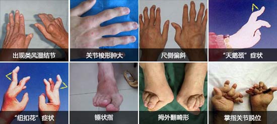 F(yng)(qing)ֱt(y)ԺL(fng)ָ_ֺȶ̎P(gun)(ji).jpg