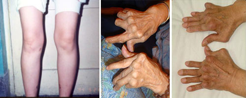 F(yng)(qing)ֱt(y)Ժ-(li)L(fng)P(gun)(ji)ײ.jpg