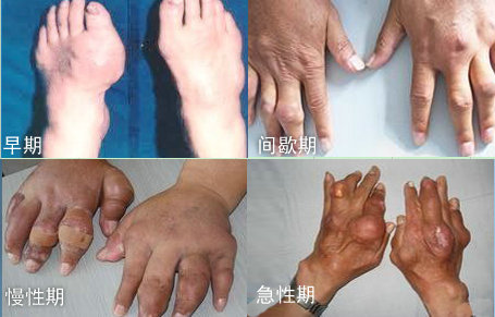 Fꖏ(qing)ֱt(y)ԺʹL(fng)l(f)Ă(g)r(sh)ڰY.jpg
