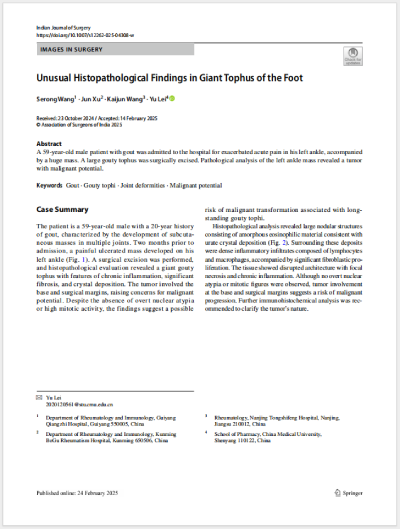 25ɫεȹͬ׫¡Unusual Histopathological Findings in Giant Tophus of the Foot㲿޴ʹLʯĮMWF(xin)SCIڿIndian Journal of Surgeryl(f).png